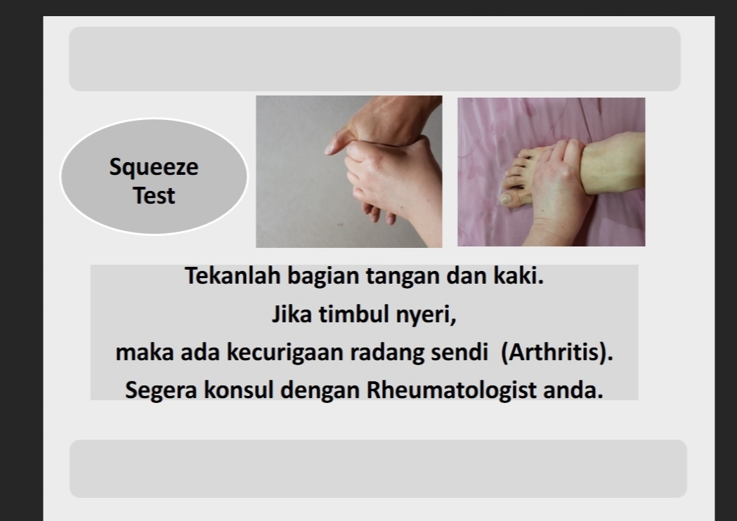 Rheumatoid Arthritis Seronegatif 1